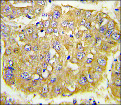 Anti-IGFBP3 (N-term) antibody produced in rabbit IgG fraction of antiserum, buffered aqueous solution