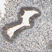 Anti-RNF180 antibody produced in rabbit Prestige Antibodies® Powered by Atlas Antibodies, affinity isolated antibody, buffered aqueous glycerol solution