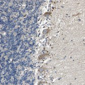 Anti-TM9SF2 antibody produced in rabbit Prestige Antibodies® Powered by Atlas Antibodies, affinity isolated antibody, buffered aqueous glycerol solution