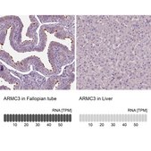 Anti-ARMC3 antibody produced in rabbit Prestige Antibodies® Powered by Atlas Antibodies, affinity isolated antibody, buffered aqueous glycerol solution