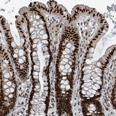Anti-KLF3 antibody produced in rabbit Prestige Antibodies® Powered by Atlas Antibodies, affinity isolated antibody, buffered aqueous glycerol solution