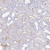 Anti-A1BG antibody produced in rabbit Prestige Antibodies® Powered by Atlas Antibodies, affinity isolated antibody, buffered aqueous glycerol solution