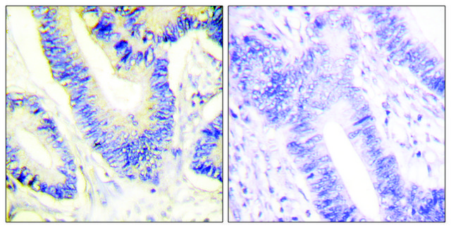 Anti-IRS-1 antibody produced in rabbit affinity isolated antibody