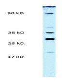 Anti-PARP11 antibody produced in rabbit affinity isolated antibody