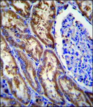 ANTI-EXOC3L (C-TERM) antibody produced in rabbit IgG fraction of antiserum, buffered aqueous solution