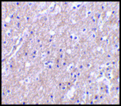 Anti-CTRP6 antibody produced in rabbit affinity isolated antibody