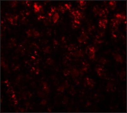 抗-AFP 兔抗 affinity isolated antibody, buffered aqueous solution