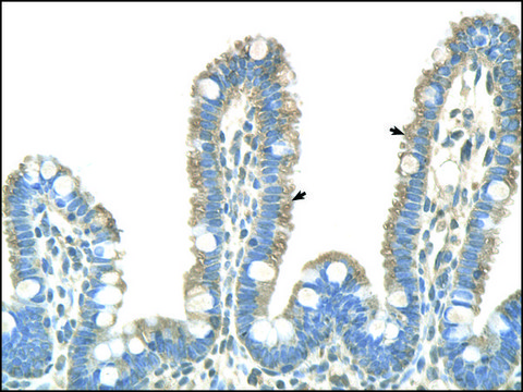 Anti-CLDN18 affinity isolated antibody