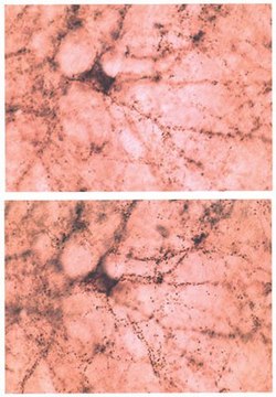 Anti-Synuclein &#946; Antibody serum, Chemicon&#174;