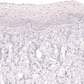 Monoclonal Anti-Lag3 Antibody Produced In Mouse Prestige Antibodies® Powered by Atlas Antibodies, clone CL14765, affinity isolated antibody, buffered aqueous glycerol solution