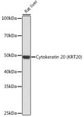 Anti-Cytokeratin 20 (KRT20) Antibody, clone 8C6A3, Rabbit Monoclonal