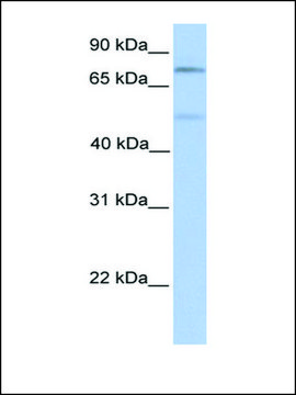 Anti-SP1 antibody produced in rabbit affinity isolated antibody