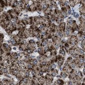 Anti-HSD17B4 antibody produced in rabbit Prestige Antibodies® Powered by Atlas Antibodies, affinity isolated antibody, buffered aqueous glycerol solution, Ab2