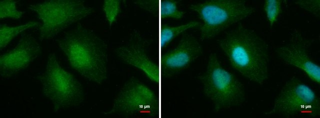 单克隆抗O-GlcNAc转移酶 小鼠抗 clone GT678, affinity isolated antibody