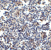 Anti-CCR5 antibody produced in rabbit affinity isolated antibody