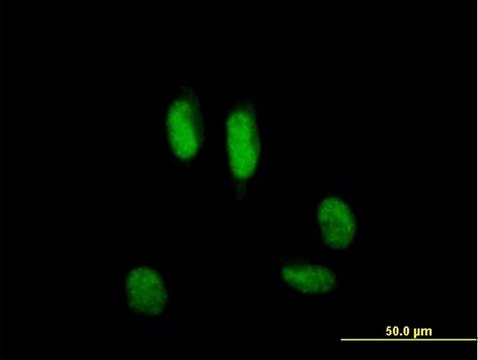 Anti-USP39 antibody produced in mouse purified immunoglobulin, buffered aqueous solution