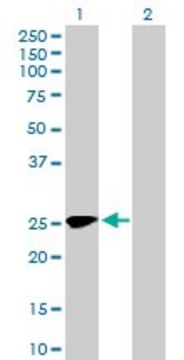 Anti-MMACHC antibody produced in mouse purified immunoglobulin, buffered aqueous solution