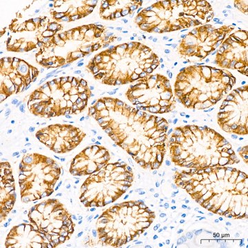 Anti-CLDN18.2 Antibody, clone 3J4G7, Rabbit Monoclonal