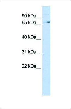 Anti-TP73 antibody produced in rabbit affinity isolated antibody