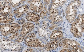 Anti-Cathepsin L1 Antibody, clone 1G2 ZooMAb® Rabbit Monoclonal recombinant, expressed in HEK 293 cells