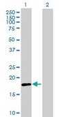 Anti-RNF170 antibody produced in mouse IgG fraction of antiserum, buffered aqueous solution