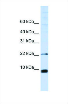 Anti-SNRPF antibody produced in rabbit affinity isolated antibody