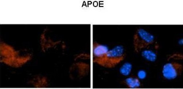 Anti-APOE (N-terminal) antibody produced in rabbit affinity isolated antibody