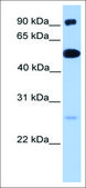 Anti-ETV5 (AB2) antibody produced in rabbit affinity isolated antibody