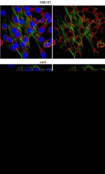 Anti-WASH complex subunit FAM21C Antibody from rabbit