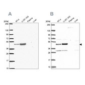Anti-RRS1 antibody produced in rabbit Prestige Antibodies® Powered by Atlas Antibodies, affinity isolated antibody, buffered aqueous glycerol solution