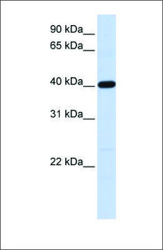 Anti-TMOD3 (ab2) antibody produced in rabbit affinity isolated antibody