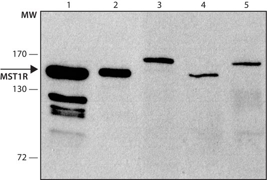 Anti-MST1R antibody produced in rabbit ~1.0&#160;mg/mL, affinity isolated antibody