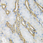 Anti-HSP90B1 antibody produced in rabbit
