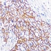 Anti-NDRG1 antibody produced in rabbit