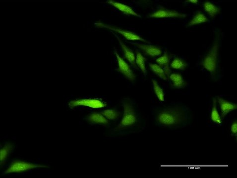 Anti-NPLOC4 antibody produced in rabbit purified immunoglobulin, buffered aqueous solution