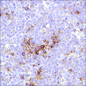 Anti-VPAC1 antibody, Rabbit monoclonal recombinant, expressed in proprietary host, clone SP234, affinity isolated antibody