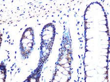 Anti-MAD2B/MAD2L2 antibody produced in rabbit