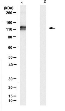 Anti-ADAR1 Antibody, clone RD4B11 clone RD4B11, from rat