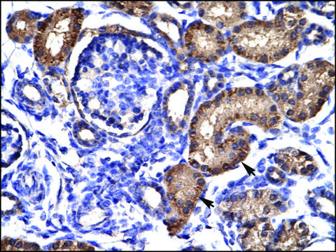 Anti-AHR IgG fraction of antiserum