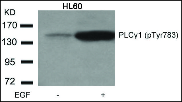 Anti-phospho-PLCG1 (pTyr783) antibody produced in rabbit affinity isolated antibody