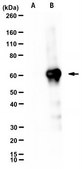 Anti-Hemagglutinin Antibody, Influenza A virus H5N8 Antibody, clone 7H6C