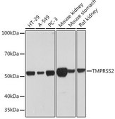 Anti-TMPRSS2 antibody produced in rabbit