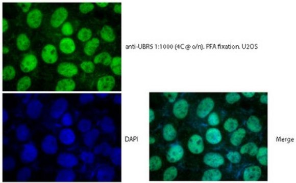 Anti-E3 ubiquitin-protein ligase (UBR5/EDD) serum, from rabbit