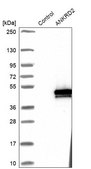 Anti-ANKRD2 antibody produced in rabbit Prestige Antibodies® Powered by Atlas Antibodies, affinity isolated antibody, buffered aqueous glycerol solution