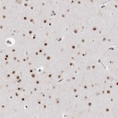 Anti-RBM6 antibody produced in rabbit Prestige Antibodies® Powered by Atlas Antibodies, affinity isolated antibody, buffered aqueous glycerol solution, Ab2