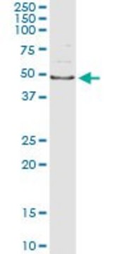 Monoclonal Anti-AIPL1, (N-terminal) antibody produced in mouse clone 3A3, purified immunoglobulin, buffered aqueous solution