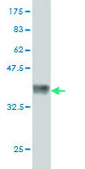 Monoclonal Anti-CACNB2 antibody produced in mouse clone 6C1, purified immunoglobulin, buffered aqueous solution