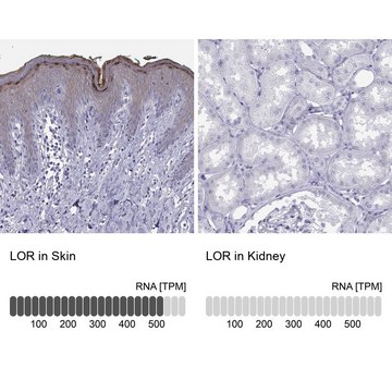 Anti-LOR Prestige Antibodies&#174; Powered by Atlas Antibodies, affinity isolated antibody