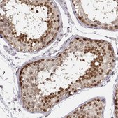 Anti-POLI antibody produced in rabbit Prestige Antibodies® Powered by Atlas Antibodies, affinity isolated antibody