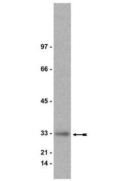 Anti-Kip1 (p27) Antibody Upstate&#174;, from rabbit